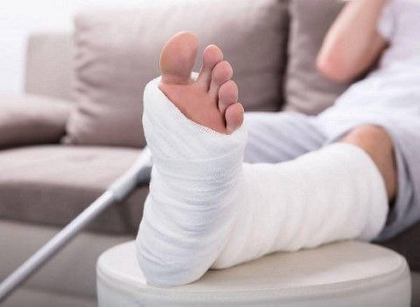 تصویر 3 از خرید گچ ارتوپدی ضد آب + بهترین قیمت