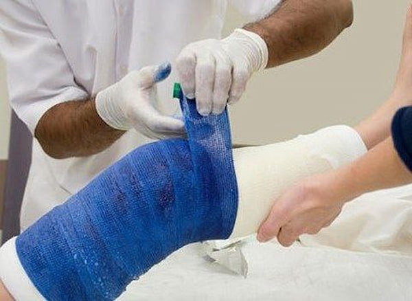 تصویر 4 از خرید گچ ارتوپدی ضد آب + بهترین قیمت