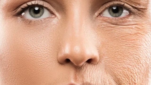 تصویر 3 از خرید و فروش سرم سفت کننده وپرکننده وایپر با شرایط فوق العاده