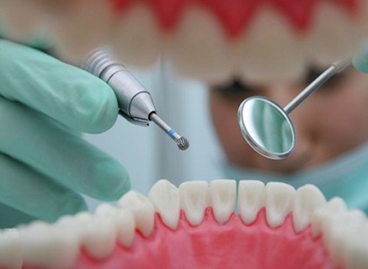 تصویر 4 از قیمت الواتور مثلثی دندانپزشکی + خرید باور نکردنی