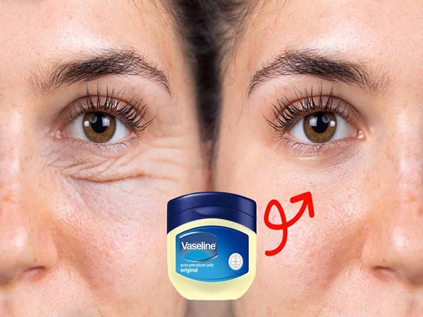 تصویر 3 از خرید وازلین ضد چروک + قیمت فروش استثنایی