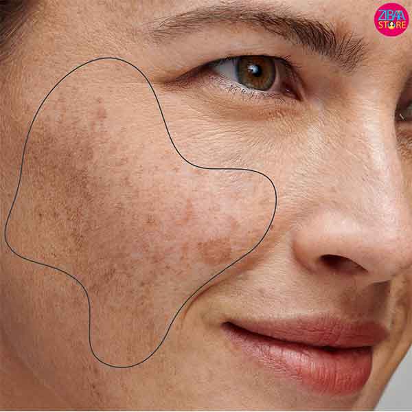 قیمت خرید کرم آبرسان ضد لک با فروش عمده