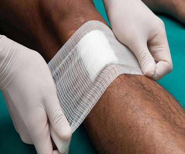 تصویر 5 از فروش گاز استریل تکی + قیمت خرید به صرفه