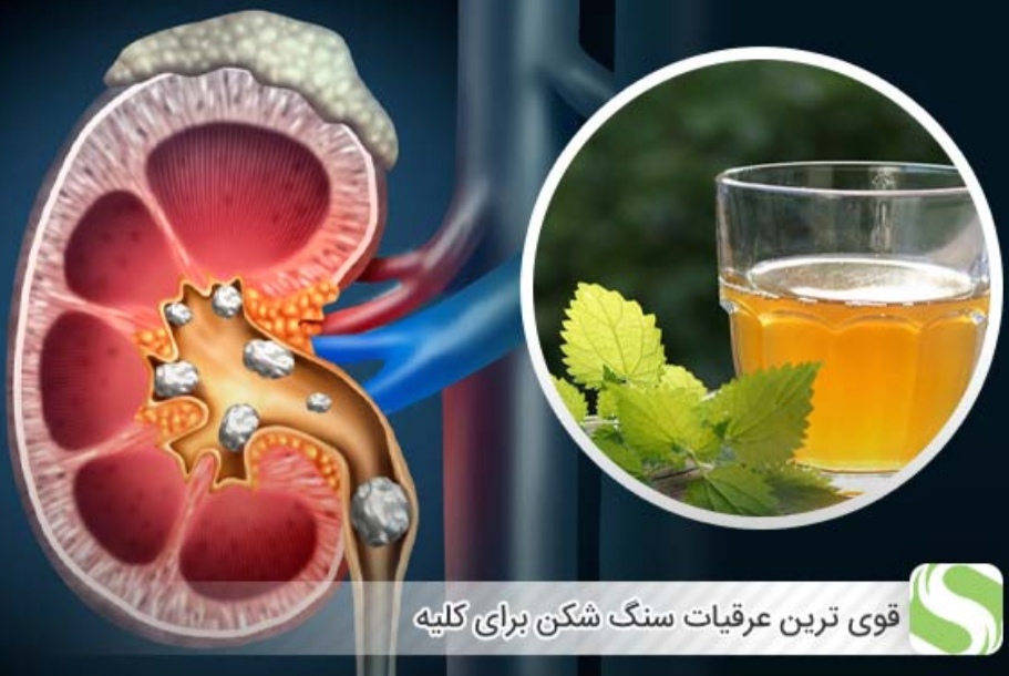 تصویر 1 از خرید و فروش قیمت عمده عرق سنگ شکن کلیه