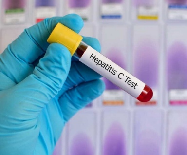 تصویر 3 از فروش کیت تشخیص سریع hcv آنتی بادی عمده