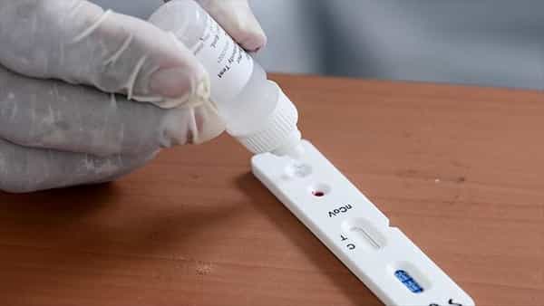 تصویر 5 از قیمت خرید کیت آزمایشگاهی سریع رپید با فروش عمده