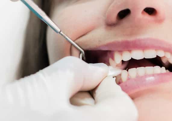 تصویر 1 از گاز استریل دندانپزشکی قیمت مناسب