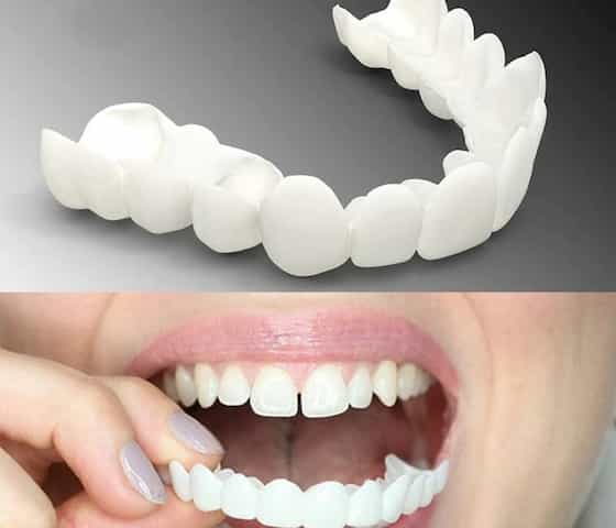 تصویر 5 از فروش لمینت متحرک دندان + قیمت خرید به صرفه