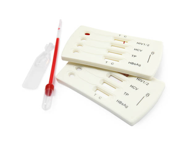 تصویر 1 از فروش کیت تشخیص آزمایشگاهی رپید اچ آی وی + قیمت خرید به صرفه