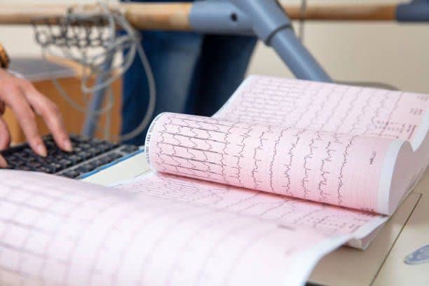 رول نوار قلب 21 سانت مناسب دستگاه های مختلف ثبت قلب
