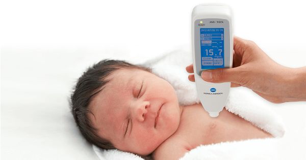 کیت تشخیص زردی نوزاد مناسب بررسی سریع بیلی روبین